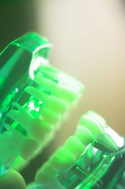 Diş ağız diş modeli