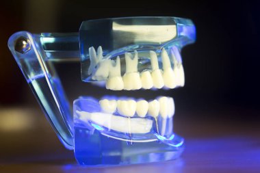 Diş diş klinik modeli