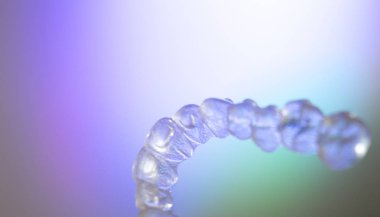 Görünmez diş aligner köşeli ayraç