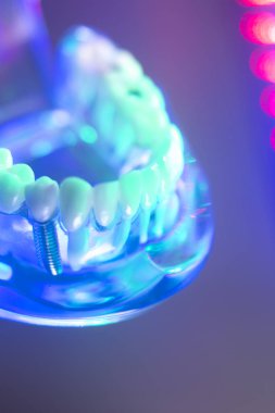 Ortodontik diş diş modeli