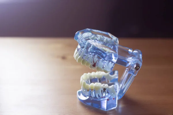치과 치아 임상 모델 — 스톡 사진