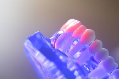 Diş sağlıklı diş modeli