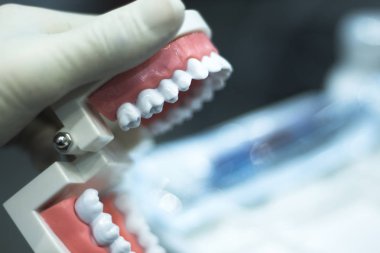 Diş diş ağız modeli