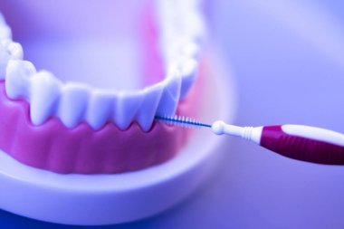 İnterdental Diş Temizleme
