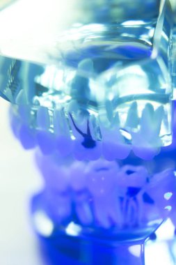 Diş diş klinik modeli