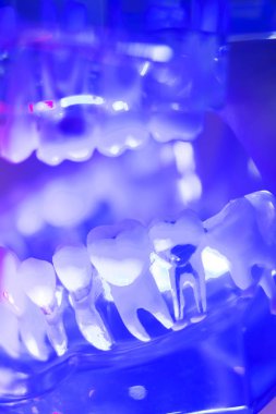 Diş sağlıklı diş modeli