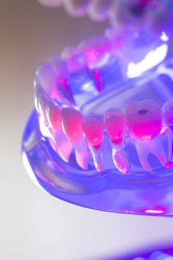 Diş sağlıklı diş modeli