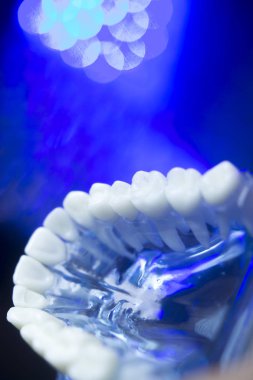 Diş hizalama diş modeli