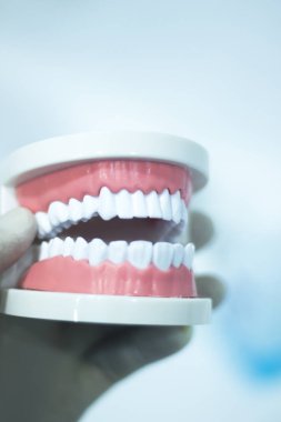 Diş diş ağız modeli