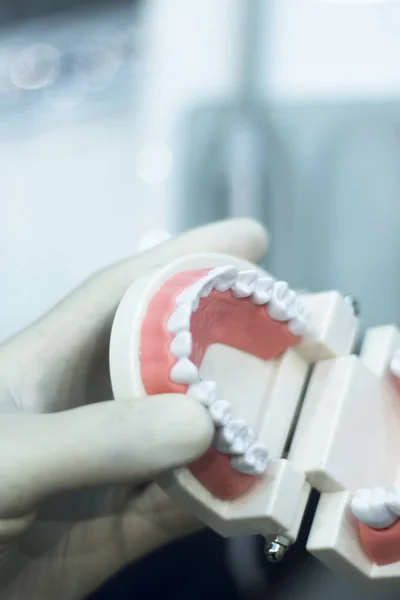 Modelo de boca de dientes dentales —  Fotos de Stock