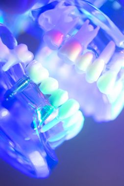 Ortodontik diş diş modeli