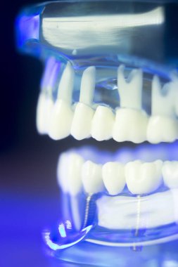 Diş diş klinik modeli