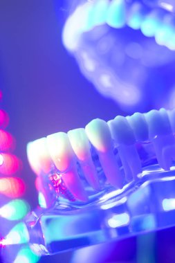 Ortodontik diş diş modeli