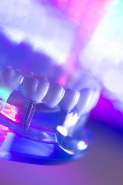 Diş hekimi diş modeli