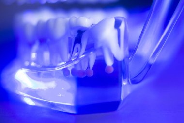 Diş diş kök sinir