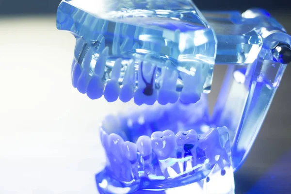 Modello clinico dentale dei denti — Foto Stock