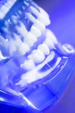 Diş hizalama diş modeli