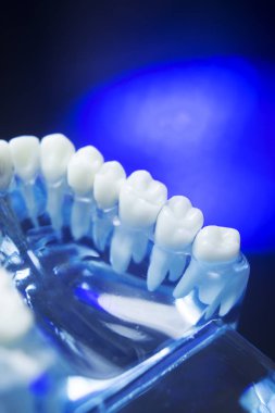 Diş diş çürümesi modeli