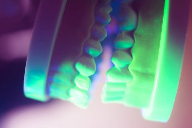 Diş ağız diş modeli