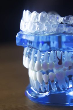 Diş diş kök modeli