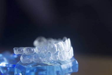 Diş diş bracets modeli