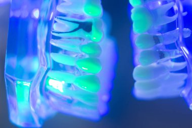 Diş diş çene modeli