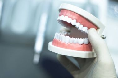 Diş diş ağız modeli