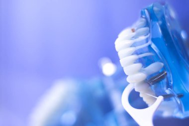 İnterdental Diş Temizleme