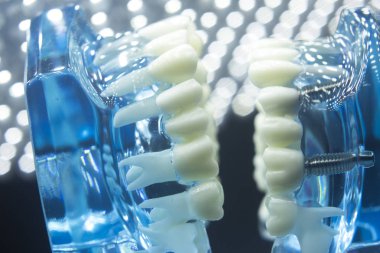 Diş hekimleri diş diş modeli