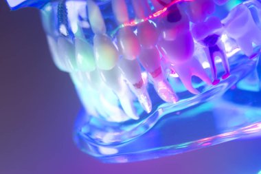 Ortodontik diş diş modeli