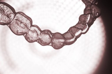 Görünmez diş aligner köşeli ayraç