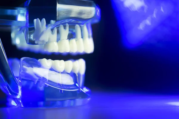 Modello clinico dentale dei denti — Foto Stock