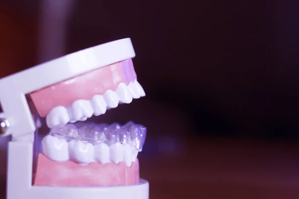 Zubní zuby v ústech zdraví — Stock fotografie