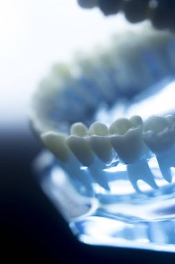 Diş diş çürümesi modeli