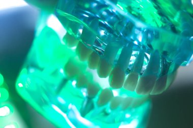 Diş ağız diş modeli