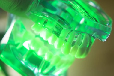 Diş ağız diş modeli