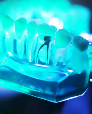 Diş ağız diş modeli