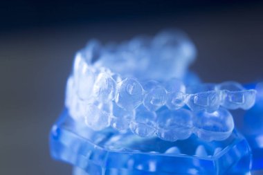 Diş diş bracets modeli