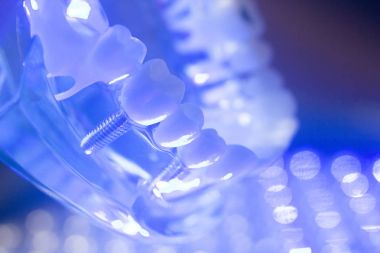 Diş diş kökleri modeli