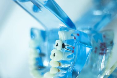 Diş diş öğrenci modeli