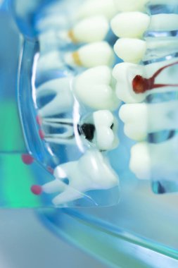 Diş diş dişçi modeli