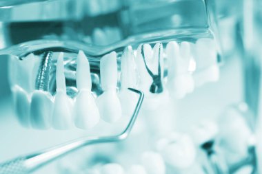 Diş diş dişçi modeli