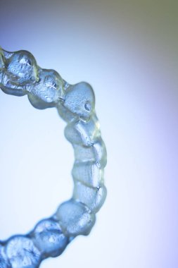 Görünmez diş aligner köşeli ayraç