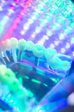 Diş hekimi diş modeli