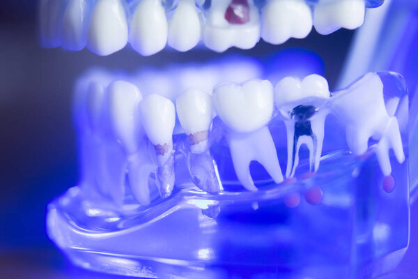 Dental  teeth root nerve