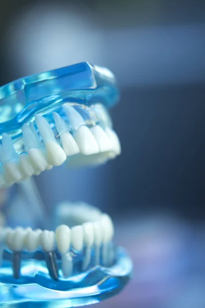 Odontoiatria insegnamento modello dentale — Foto Stock