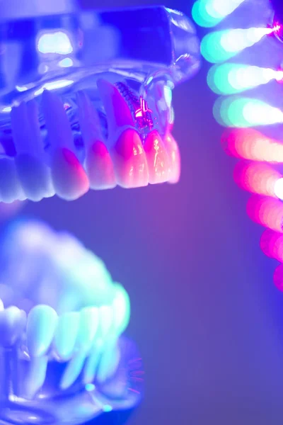 Dentes dentários modelo ortodôntico — Fotografia de Stock