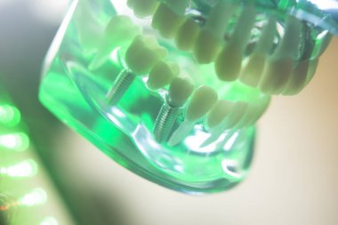 Diş ağız diş modeli