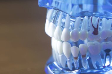 Diş diş kök modeli