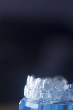 Diş diş bracets modeli